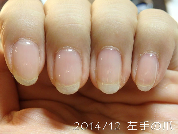 2014年12月の爪（左）