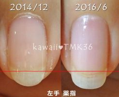 左手の薬指の爪の育ち度チェック!