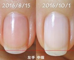 1ヶ月半の左手の中指の爪の育ち度チェック!