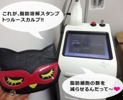 脂肪溶解スタンプ(トゥルースカルプ)は、脂肪細胞の数を減らせる♪